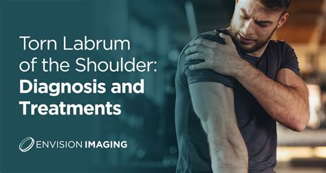 shoulder labrum tear treatment options